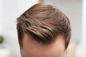 DHI Hair Transplant