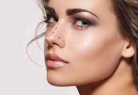 Rinoplastia