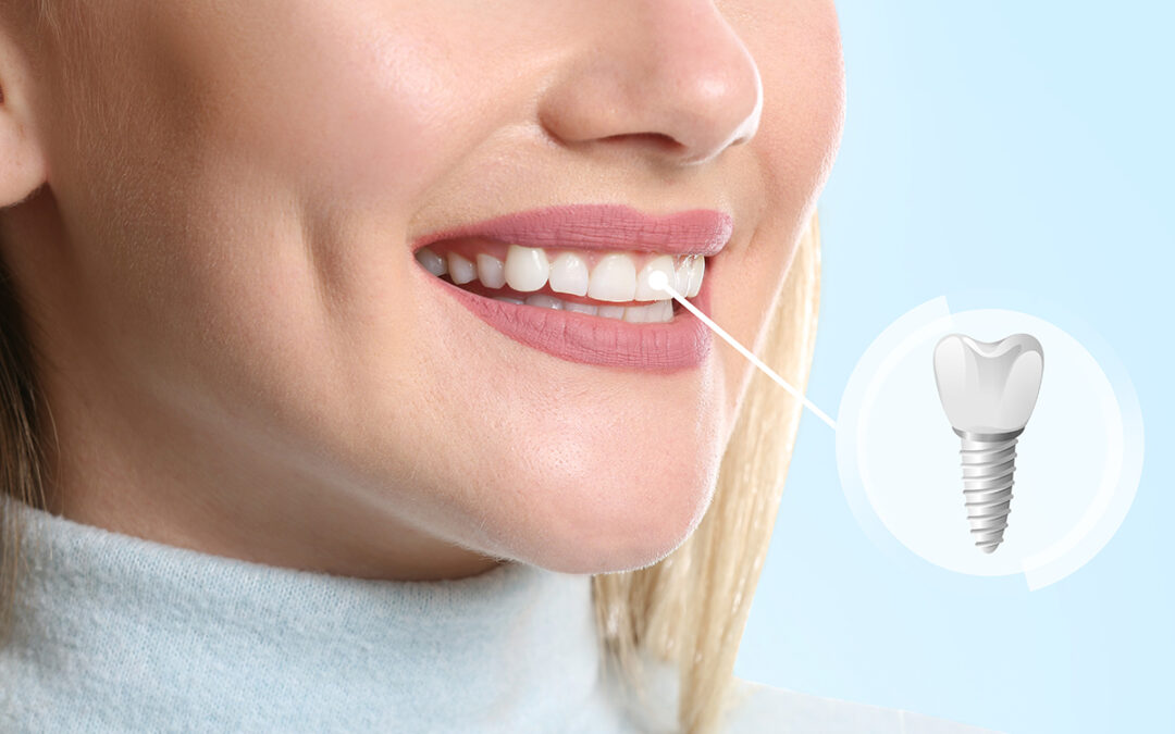 DENTAL AESTHETICS